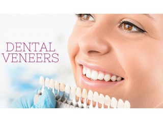 Veneers Dental Implants