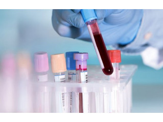 Get 40% off on Full Body Test Service