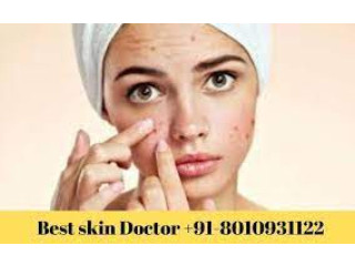Skin problem treatment in delhi