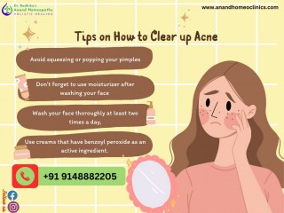 Discover Effective Homeopathy Treatment for Skin: Anand Homeopathy Clinic