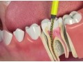 best-dentist-in-sirsi-road-small-0