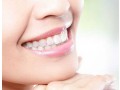 checkout-dentist-in-panchyawala-small-0