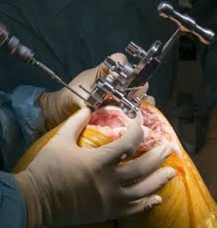 best-knee-replacement-surgeon-in-indore-dr-vinay-tantuway-big-0